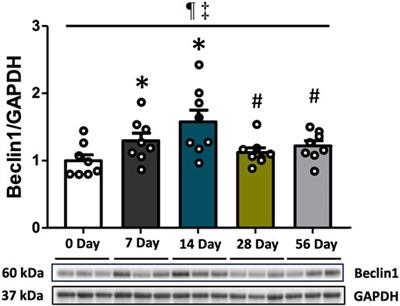 Quadriceps muscle atrophy after non-invasive anterior cruciate ligament injury: evidence linking to autophagy and mitophagy